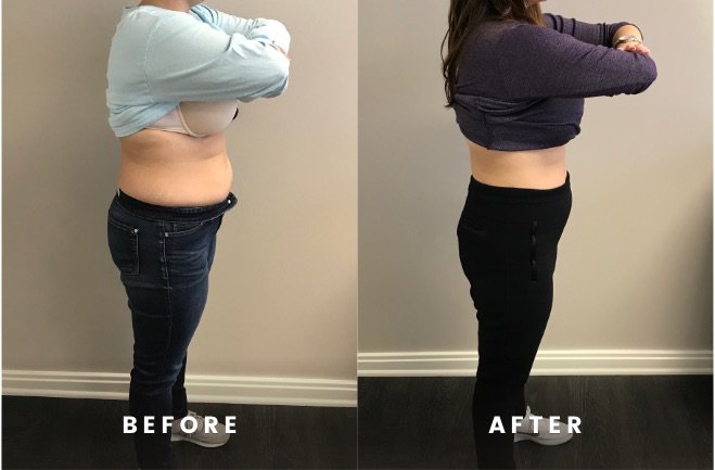 Houston TX Rapid hCG Weight Loss Programs