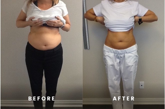 Rapid Weight Loss Diet Plans