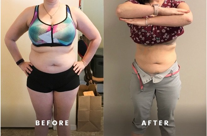 Before and after rapid weight loss hCG diet program Houston