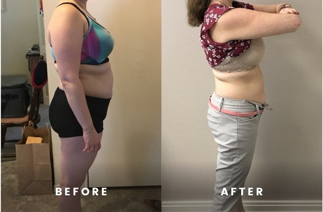 Rapid Weight Loss Before and After